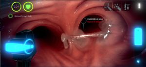 PulmEx screenshot 1